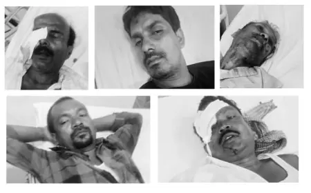 जमशेदपुर दुर्घटना : सोनारी मैरिन ड्राइव में ट्रेलर में घुसी स्कार्पियो, पांच गंभीर रुप से घायल