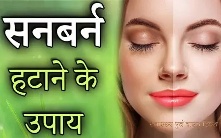 क्या आप भी सनबर्न से परेशान हैं? जानिए, इन 5 आसान तरीकों से कैसे बच सकते हैं!