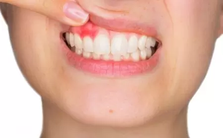 दांतों का दर्द दूर करने के घरेलू उपचार | Home Remedies For Teeth Pain in hindi