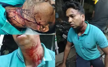 जमीन विवाद पर भाई ने भाई पर किया जानलेवा हमला, ब्रिक्स और रॉड से किया वार