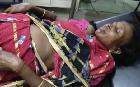 जमशेदपुर के चंडीनगर में ठनका गिरने से महिला बेहोश, एमजीएम अस्पताल में भर्ती