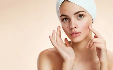 ब्लैक हेड्स हटाने के घरेलू उपाय  home remedies to get rid of blackheads hatane ke gharelu nuskhe in hindi