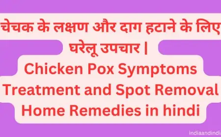 चेचक के लक्षण और दाग हटाने के लिए घरेलू उपचार | Chicken Pox Symptoms Treatment and Spot Removal Home Remedies in hindi