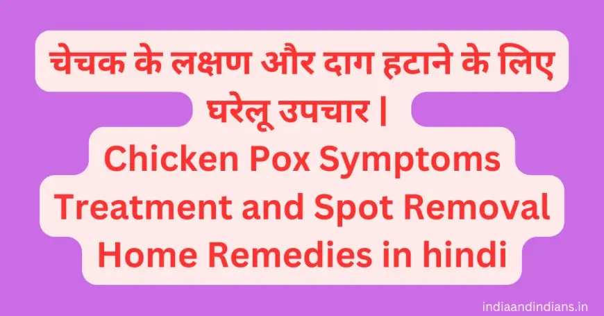 चेचक के लक्षण और दाग हटाने के लिए घरेलू उपचार | Chicken Pox Symptoms Treatment and Spot Removal Home Remedies in hindi