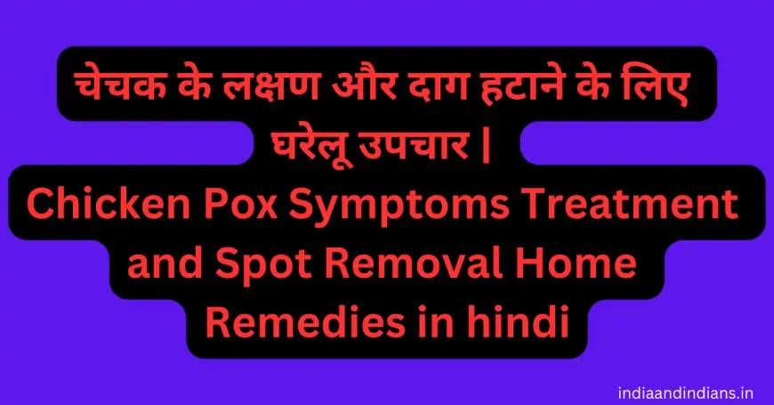 चेचक के लक्षण और दाग हटाने के लिए घरेलू उपचार | Chicken Pox Symptoms Treatment and Spot Removal Home Remedies in hindi