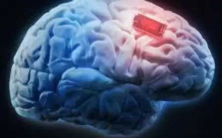 64 वर्षीय व्यक्ति ने मस्तिष्क इम्प्लांट से Amazon Alexa को विचारों से किया नियंत्रित