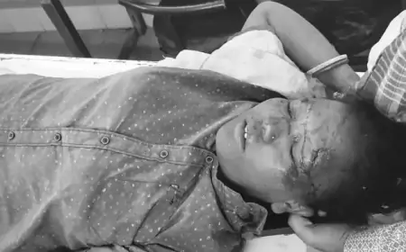 आदित्यपुर में तेज रफ्तार कार की टक्कर से महिला गंभीर रूप से घायल, ड्राइवर फरार