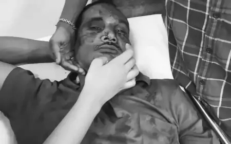 मामूली टक्कर पर हमला: जमशेदपुर में व्यक्ति पर ईंट-पत्थरों से जानलेवा हमला, पुलिस पर पैसे लेकर आरोपी को रिहा करने का आरोप