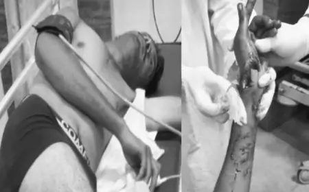 तिब्बत मार्केट के पास चापड़ से जानलेवा हमला, युवक गंभीर रूप से घायल