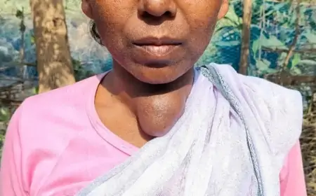 Woman Appeal for Help: गालूडीह में गले के ट्यूमर से जूझ रही महिला, प्रशासन से मदद की अपील!