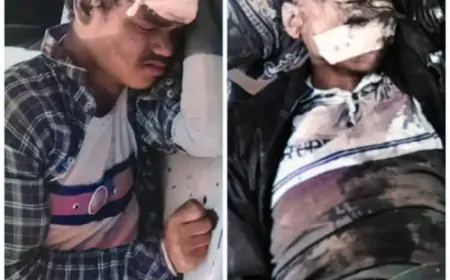 Ghatshila Bike Accident: घाटशिला में बाइक टक्कर से गंभीर हादसा, स्थानीय संस्था ने की मदद, जानें क्या हुआ!