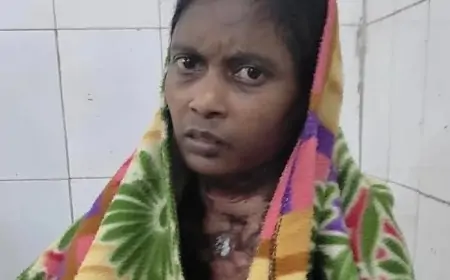 Jamshedpur Incident: चूल्हे पर खाना बनाते वक्त महिला झुलसी, महिला के शरीर के 50 फीसदी जलने से मची अफरा-तफरी