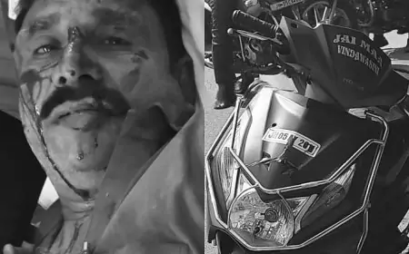 Jamshedpur Accident: स्कूटी से लौट रहे बस कंडक्टर की बड़ी चूक, हादसे में हुए घायल