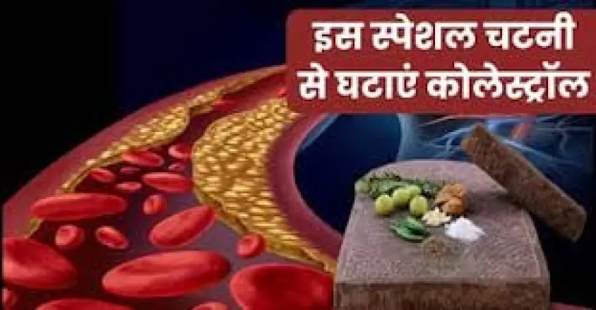 Health Alert: ये 4 चटनियां करेंगी बैड कोलेस्ट्रॉल का सफाया,कोलेस्ट्रॉल घटाने के लिए रोज़ खाएं ये चटनी, डॉक्टर भी देते हैं सलाह!