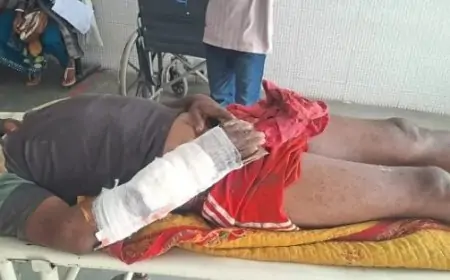 Chakradharpur Accident: लकड़ी काटते समय पेड़ से गिरा युवक, एक हाथ और पैर टूटे!