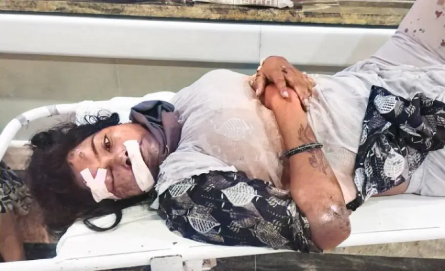 Jamshedpur Accident: बिष्टुपुर सर्किट हाउस के पास स्कूटी सवार युवती को अज्ञात वाहन ने मारी जोरदार टक्कर
