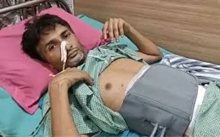 Bulandshahr Shock : युवक ने गुस्से में निगल लिए 29 चम्मच और 19 टूथब्रश, डॉक्टर भी रह गए दंग