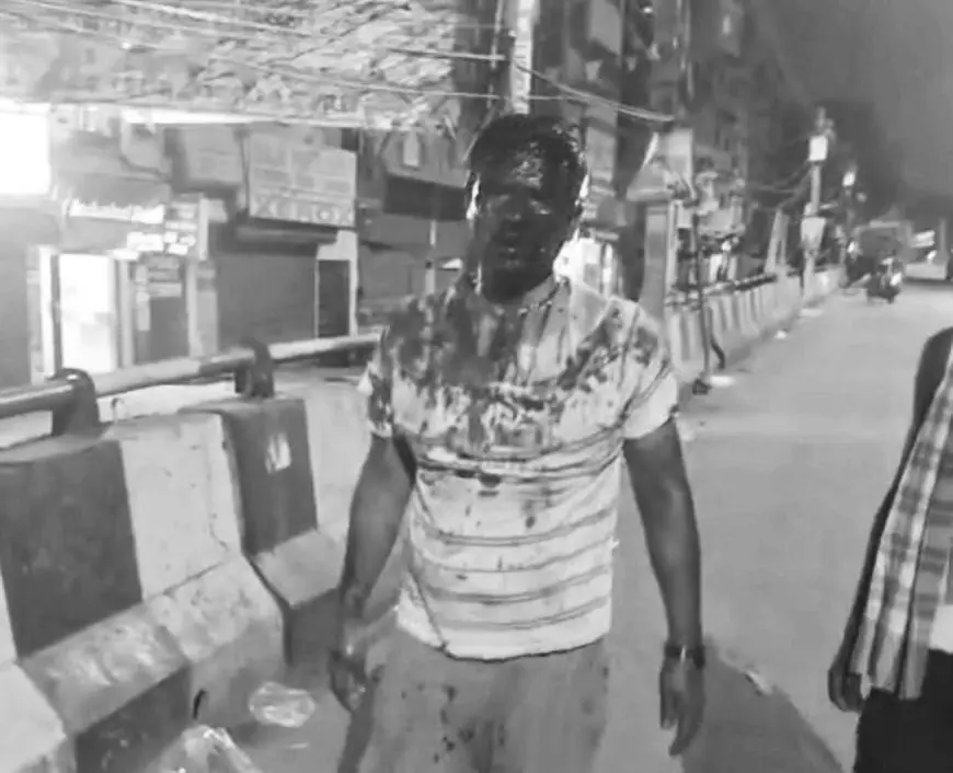 Adityapur Attack: जलापूर्ति कंपनी कर्मचारियों पर जानलेवा हमला, सुपरवाइजर घायल