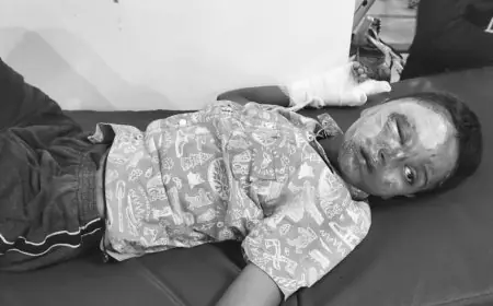 Jamshedpur Blast: पटाखे से खेलते हुए फटा बारूद, 11 साल का पीयूष बुरी तरह झुलसा — अस्पताल में चल रहा इलाज!