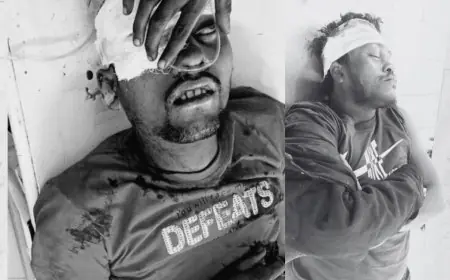 Bahargora Accident: बहरागोड़ा में मोटरसाइकिल की टक्कर से 4 लोग बुरी तरह घायल हुए, बच्ची सहित घायलों का हाल खुला