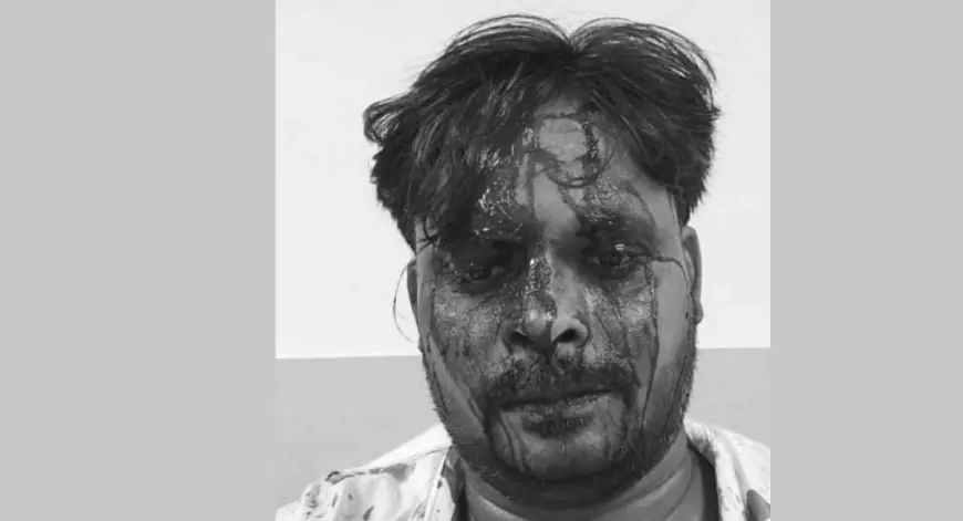 Jamshedpur Attack: जमशेदपुर में थाना से लौट रहे वकील पर जानलेवा हमला, लोहे की रॉड से सिर फाड़ा, MGM में इलाज