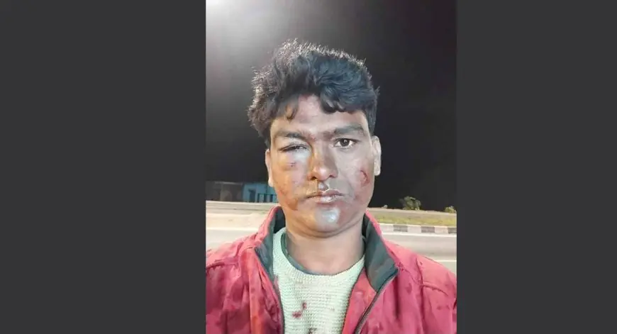 Galudih Clash Breaking: भाजपा जिला महामंत्री समेत 5 पर जानलेवा हमला का केस, शादी की पार्टी में उप मुखिया पति से मारपीट, क्या थी हमले की वजह?