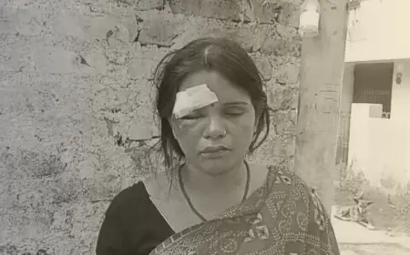 Golmuri Attack Alert: टिनप्लेट मंदिर के पास छिनतई, पर्स बचाने की कोशिश में महिला सड़क पर गिरी और गंभीर घायल