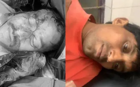 Manoharpur Crash: तीखे मोड़ पर सीआरपीएफ जवान की बाइक अनियंत्रित, सिर पर आई गंभीर चोट