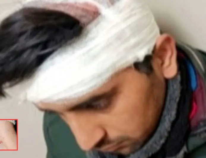 Jamshedpur Fight: संपत्ति विवाद में बड़ा घरेलू झगड़ा, एक युवक की हालत गंभीर सीटी स्कैन जारी