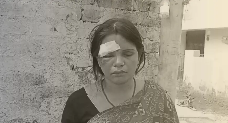 Golmuri Attack Alert: टिनप्लेट मंदिर के पास छिनतई, पर्स बचाने की कोशिश में महिला सड़क पर गिरी और गंभीर घायल