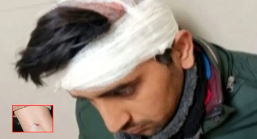 Jamshedpur Fight: संपत्ति विवाद में बड़ा घरेलू झगड़ा, एक युवक की हालत गंभीर सीटी स्कैन जारी