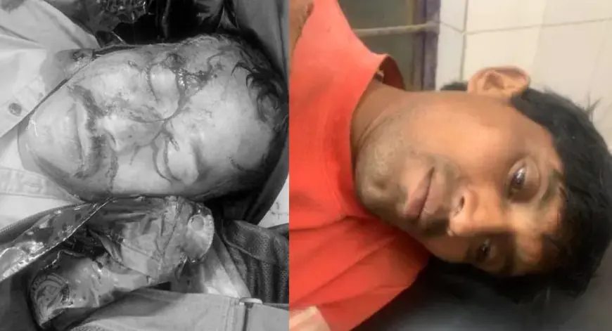 Manoharpur Crash: तीखे मोड़ पर सीआरपीएफ जवान की बाइक अनियंत्रित, सिर पर आई गंभीर चोट