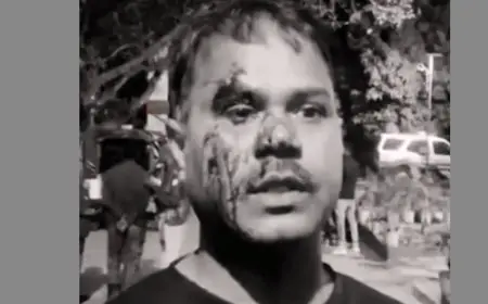 Birsanagar Attack: बिरसानगर में छुट्टे पैसे के विवाद में दुकान में घुसकर खूनी खेल, मां और दो बेटों को अधमरा कर भागे हमलावर, इलाके में दहशत