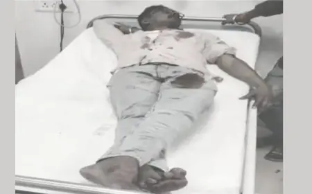 Burmamines Attack: ईस्ट प्लांट बस्ती में आधी रात चापड़ से खूनी हमला, टिंकू सिंह और उसका साथी लहूलुहान, पुरानी रंजिश में बदमाशों ने सरेआम मचाया तांडव