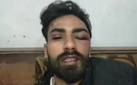 Mango Violence: उधार के 20 हजार मांगे तो मिली लहूलुहान कर देने वाली चोट, ओसामा उर्फ़ लादेन पर फैजल राजू का जानलेवा हमला