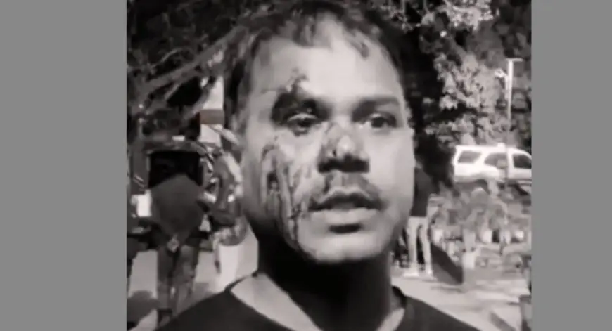 Birsanagar Attack: बिरसानगर में छुट्टे पैसे के विवाद में दुकान में घुसकर खूनी खेल, मां और दो बेटों को अधमरा कर भागे हमलावर, इलाके में दहशत