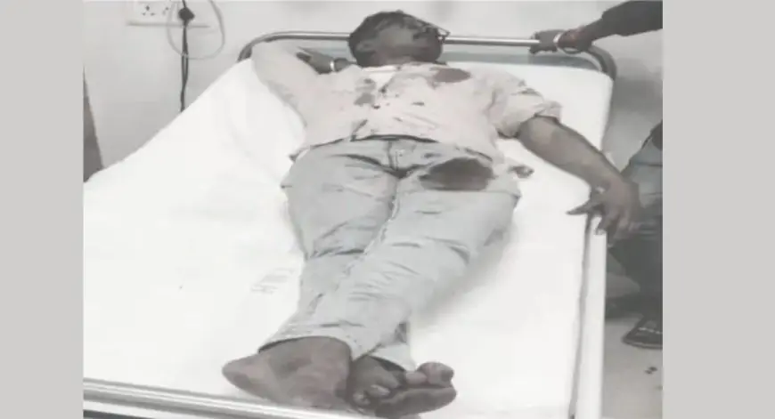 Burmamines Attack: ईस्ट प्लांट बस्ती में आधी रात चापड़ से खूनी हमला, टिंकू सिंह और उसका साथी लहूलुहान, पुरानी रंजिश में बदमाशों ने सरेआम मचाया तांडव