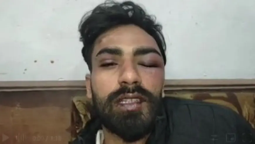 Mango Violence: उधार के 20 हजार मांगे तो मिली लहूलुहान कर देने वाली चोट, ओसामा उर्फ़ लादेन पर फैजल राजू का जानलेवा हमला