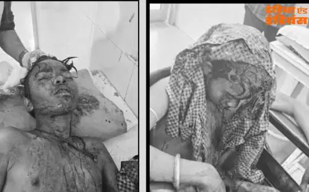 Potka Crash :  हाता-मुसाबनी मार्ग पर बाइक फिसली, परीक्षा देकर लौट रहे कक्षा 9 के तीन छात्र लहूलुहान, दो की हालत बेहद नाजुक