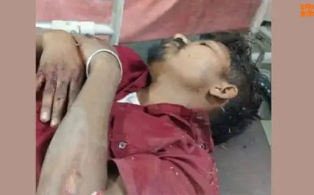 Seraikela Accident : सरायकेला में ट्रक की हेडलाइट ने छीन ली आंखों की रोशनी, बाइक से गिरा युवक, मेला देख लौटते वक्त हुआ हादसा