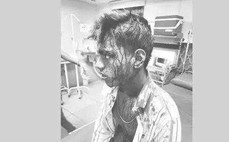 Telco Terror: जमशेदपुर के टेल्को में खूनी खेल, नाबालिगों ने सिर पर रिवॉल्वर सटाकर किया अपहरण, फिर अभय और दीपक को बेरहमी से पीटा