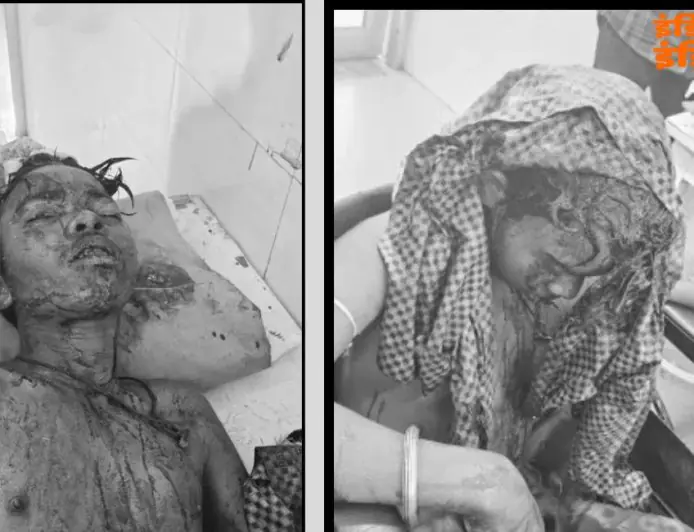 Potka Crash :  हाता-मुसाबनी मार्ग पर बाइक फिसली, परीक्षा देकर लौट रहे कक्षा 9 के तीन छात्र लहूलुहान, दो की हालत बेहद नाजुक