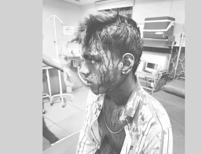 Telco Terror: जमशेदपुर के टेल्को में खूनी खेल, नाबालिगों ने सिर पर रिवॉल्वर सटाकर किया अपहरण, फिर अभय और दीपक को बेरहमी से पीटा