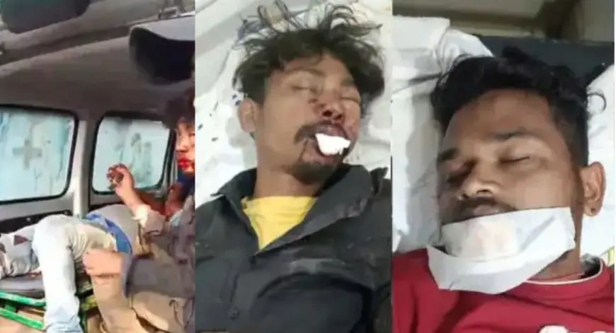 Jamshedpur Crash: जमशेदपुर में ओवरटेक के चक्कर में दो बाइक की सीधी भिड़ंत, 3 युवक लहूलुहान, बंगाल तक पहुंची हादसे की गूँज
