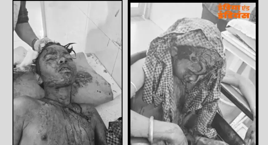 Potka Crash :  हाता-मुसाबनी मार्ग पर बाइक फिसली, परीक्षा देकर लौट रहे कक्षा 9 के तीन छात्र लहूलुहान, दो की हालत बेहद नाजुक