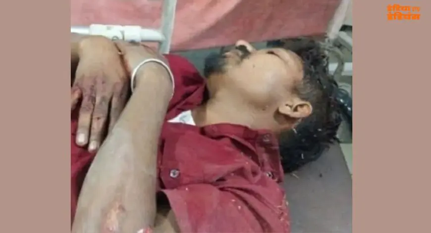 Seraikela Accident : सरायकेला में ट्रक की हेडलाइट ने छीन ली आंखों की रोशनी, बाइक से गिरा युवक, मेला देख लौटते वक्त हुआ हादसा