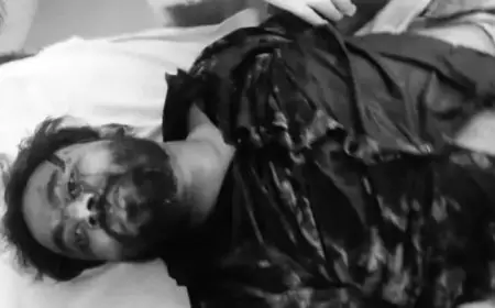 Golmuri Firing:  गोलमुरी के बजरंगनगर में अपराधियों का तांडव, आकाश सिंह पर चापड़ से ताबड़तोड़ वार, पुरानी रंजिश में दहला इलाका