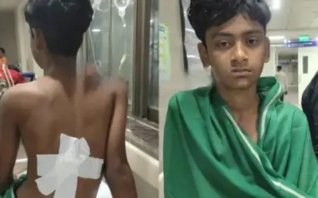 Kapali Stabbing: कपाली में क्रिकेट मैदान पर मजाक का खौफनाक अंत, 14 साल के ज़ैद की पीठ में घोंपा डैगर, एमजीएम अस्पताल में भर्ती