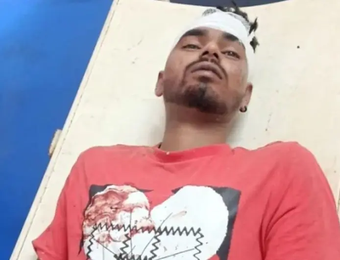 Baharagora Accident: बहरागोड़ा फ्लाईओवर पर डिवाइडर से टकराई बाइक, होटल कर्मी चंदन की हालत नाजुक