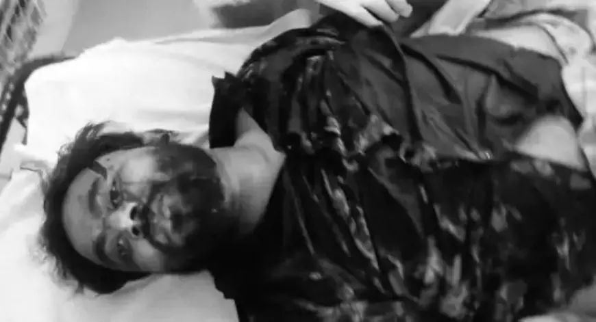 Golmuri Firing:  गोलमुरी के बजरंगनगर में अपराधियों का तांडव, आकाश सिंह पर चापड़ से ताबड़तोड़ वार, पुरानी रंजिश में दहला इलाका